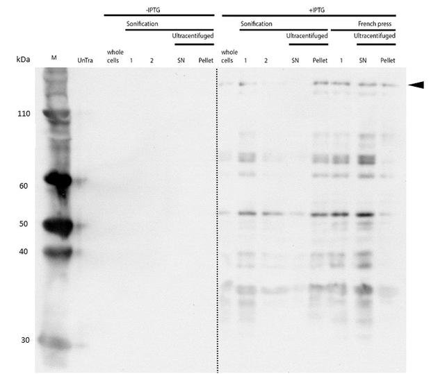 Figure 6B) Specific detection of mDNMT1(731-1602)