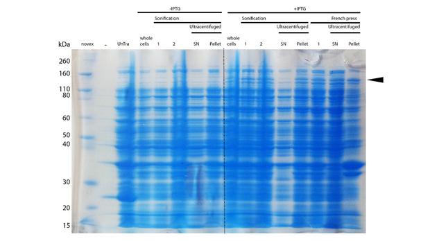 Figure 6A) Comparison of DNMT1 extraction from bacteria by French press and sonification