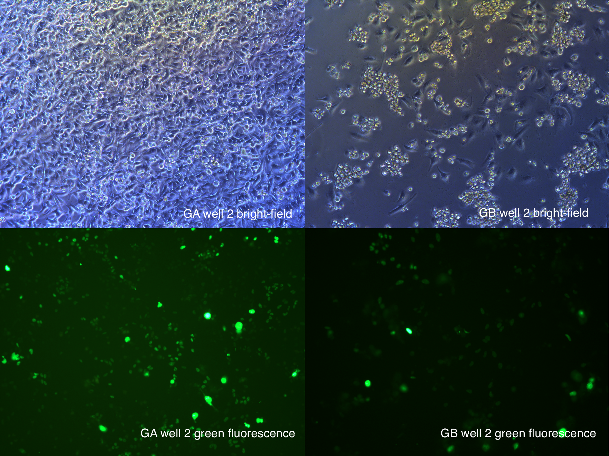 GA GB 108 hours after transfection